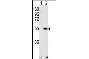 Western blot analysis of CK1G (arrow) using rabbit polyclonal CK1G (Center ) Antibody (ABIN391377 and ABIN2841388). (CAMK1G antibody  (AA 211-241))
