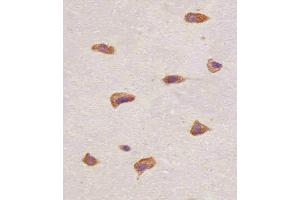 Immunohistochemistry (Paraffin-embedded Sections) (IHC (p)) image for anti-Fibroblast Growth Factor Receptor 1 (FGFR1) (AA 806-842), (C-Term) antibody (ABIN6243222)