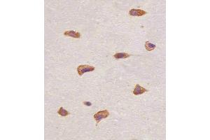 (ABIN6243222 and ABIN6577089) staining FGFR1 in human brain tissue sections by Immunohistochemistry (IHC-P - paraformaldehyde-fixed, paraffin-embedded sections). (FGFR1 antibody  (C-Term))
