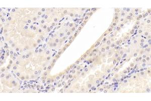 Detection of a2PI in Human Kidney Tissue using Monoclonal Antibody to Alpha 2-Antiplasmin (a2PI) (alpha 2 Antiplasmin antibody)