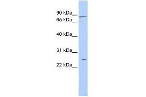 WB Suggested Anti-ZNF613 Antibody Titration:  0.