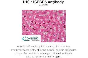 Image no. 1 for anti-Insulin-Like Growth Factor Binding Protein 5 (IGFBP5) (AA 192-206) antibody (ABIN1735787) (IGFBP5 antibody  (AA 192-206))