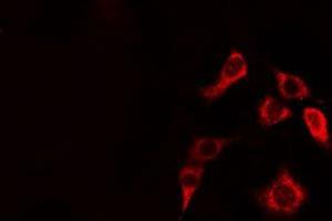 ABIN6274948 staining HepG2 cells by IF/ICC.