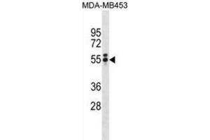 Western Blotting (WB) image for anti-T Antigen antibody (ABIN3001361) (T Antigen antibody)