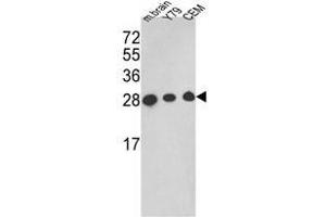 Western blot analysis of TPI1 Antibody (TPI1 antibody  (C-Term))