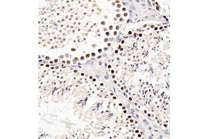 Immunohistochemistry of paraffin embedded mouse testis using sav1 (ABIN7075505) at dilution of 1:200 (400x lens)