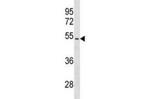 PTEN antibody western blot analysis in NCI-H460 lysate. (PTEN antibody  (AA 361-390))