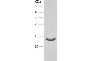 Western Blotting (WB) image for Immunoglobulin J Polypeptide, Linker Protein For Immunoglobulin alpha and mu Polypeptides (IGJ) (AA 22-159) protein (His tag) (ABIN7123408) (IGJ Protein (AA 22-159) (His tag))