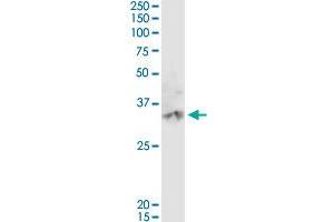 CA3 MaxPab rabbit polyclonal antibody. (CA3 antibody  (AA 1-260))