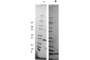 SDS-PAGE of Human Platelet Derived Growth Factor-BB Recombinant Protein SDS-PAGE of Human Platelet Derived Growth Factor-BB Recombinant Protein. (PDGF-BB Homodimer Protein)