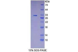 SDS-PAGE analysis of Human gSAP Protein.