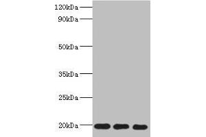 Western blot All lanes: NAA50 antibody at 5? (NAA5 (AA 1-169) antibody)