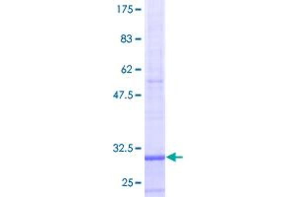 HSC70 Interacting Protein HIP Protein (AA 1-58) (GST tag)