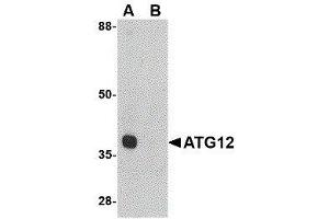 Western Blotting (WB) image for anti-Autophagy Related 12 (ATG12) (Internal Region) antibody (ABIN2477523) (ATG12 antibody  (Internal Region))
