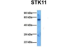 Host:  Rabbit  Target Name:  STK11  Sample Tissue:  Human 293T  Antibody Dilution:  1.