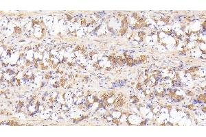 Detection of IL17RD in Human Stomach Tissue using Polyclonal Antibody to Interleukin 17 Receptor D (IL17RD) (IL17RD antibody  (AA 157-299))