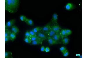 OSBPL7 antibody  (AA 1-249)