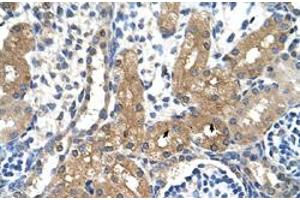 Immunohistochemical staining (Formalin-fixed paraffin-embedded sections) of human kidney with CYP4A22 polyclonal antibody  at 4-8 ug/mL working concentration.
