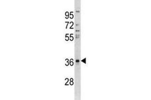 Anti-CTGF antibody western blot analysis in A549 lysate (CTGF antibody  (AA 166-193))