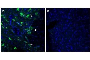 Expression of SLC6A15 in rat dorsal Raphe nucleus. (SLC6A15 antibody  (C-Term, Intracellular))