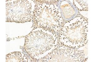 ABIN6263163 and ABIN6266587 at 1/100 staining Rat testis tissue by IHC-P.