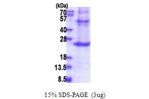 SDS-PAGE (SDS) image for Protein C Receptor, Endothelial (PROCR) (AA 18-210) protein (His tag) (ABIN5853649)