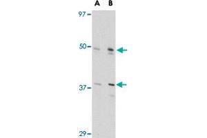 Western blot analysis of FEZ2 in NIH/3T3 cell lysate with FEZ2 polyclonal antibody  at (A) 0. (FEZ2 antibody  (Internal Region))