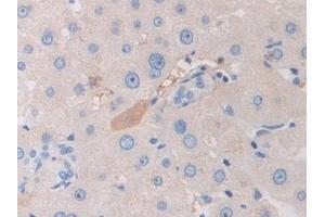 Immunohistochemistry (IHC) image for anti-Pregnancy Zone Protein (PZP) (AA 1212-1391) antibody (ABIN7436252)