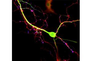 Immunofluorescence labeling of cultured hippocampus neurons (DIV 14) with anti-MAP 2, specific for dendrites (dilution 1 : 1000, green)and guinea-pig anti-Tau, specific for axons (Cat. (MAP2 antibody  (AA 2-309))