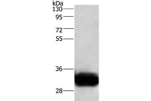 Western Blot analysis of Human fetal brain tissue using GPM6A Polyclonal Antibody at dilution of 1:950 (GPM6A antibody)