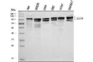 Western blot analysis of ATF6 using anti-ATF6 antibody (ABIN7601704).