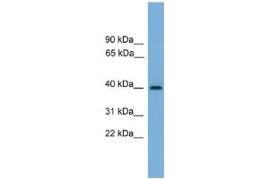 WB Suggested Anti-SERPINB8 Antibody Titration: 0. (SERPINB8 antibody  (Middle Region))