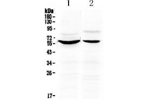 Western blot analysis of KPNA2 using anti-KPNA2 antibody . (KPNA2 antibody  (N-Term))