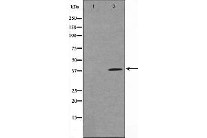 Western blot analysis on COLO205 cell lysate using TUSC3 Antibody,The lane on the left is treated with the antigen-specific peptide. (TUSC3 antibody  (Internal Region))