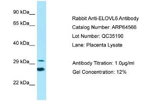 Western Blotting (WB) image for anti-ELOVL Fatty Acid Elongase 6 (ELOVL6) (N-Term) antibody (ABIN2789880) (ELOVL6 antibody  (N-Term))