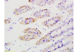 Formalin-fixed and paraffin embedded mouse stomach tissue labeled with Anti-Tenascin C/Tn-C Polyclonal Antibody, Unconjugated  at 1:200 followed by conjugation to the secondary antibody and DAB staining (TNC antibody  (AA 1001-1100))