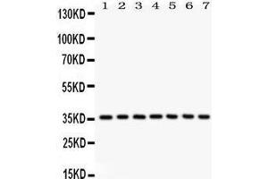 Anti- PP2A-alpha Picoband antibody, Western blotting All lanes: Anti PP2A-alpha  at 0. (PPP2CA antibody  (AA 1-309))