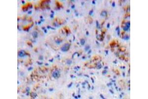 Used in DAB staining on fromalin fixed paraffin-embedded Liver tissue (Nicastrin antibody  (AA 420-655))