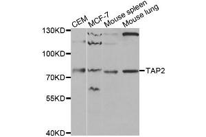 Western blot analysis of extracts of various cell lines, using TAP2 antibody. (TAP2 antibody)