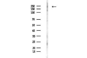 Western blot analysis of lysates from F10-LUC cells(starvation 24h treatment), using BRG1 Antibody at 1/1000 dilution.