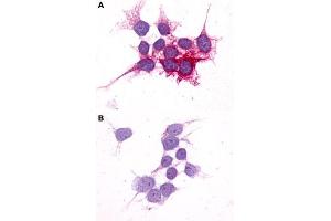 Immunocytochemistry (ICC) staining of HEK293 human embryonic kidney cells transfected (A) or untransfected (B) with P2RY14. (P2RY14 antibody  (C-Term))