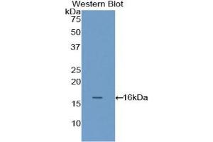 Figure. (FLNB antibody  (AA 1-237))