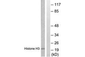 Western blot analysis of extracts from HuvEc cells, treated with Serum 20% 30', using Histone H3 (Ab-28) Antibody.