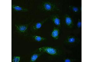 anti-Calpastatin (CAST) (AA 275-310), (Middle Region) antibody