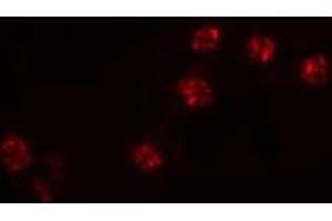 ABIN6274516 staining NIH-3T3 cells by IF/ICC. (ZNF287 antibody)