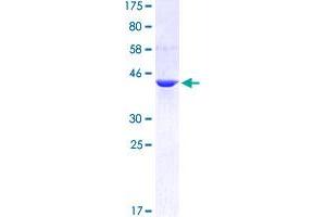 Image no. 1 for Cytohesin 3 (CYTH3) (AA 1-179) protein (GST tag) (ABIN1351040) (Cytohesin 3 Protein (CYTH3) (AA 1-179) (GST tag))