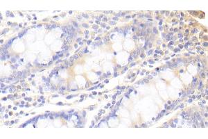 Detection of SNX9 in Human Colon Tissue using Polyclonal Antibody to Sorting Nexin 9 (SNX9) (SNX9 antibody  (AA 250-595))