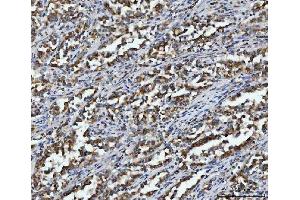 IHC analysis of Aconitase 2 using anti-Aconitase 2 antibody (ABIN7602770). (ACO2 antibody  (C-Term))