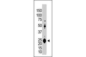 The UCHL1 polyclonal antibody  is used in Western blot to detect UCHL1 in Jurkat cell lysate. (UCHL1 antibody  (N-Term))