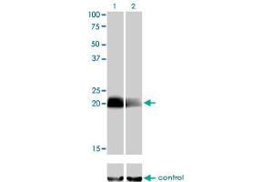 Western blot analysis of CITED1 over-expressed 293 cell line, cotransfected with CITED1 Validated Chimera RNAi (Lane 2) or non-transfected control (Lane 1). (CITED1 antibody  (AA 94-193))
